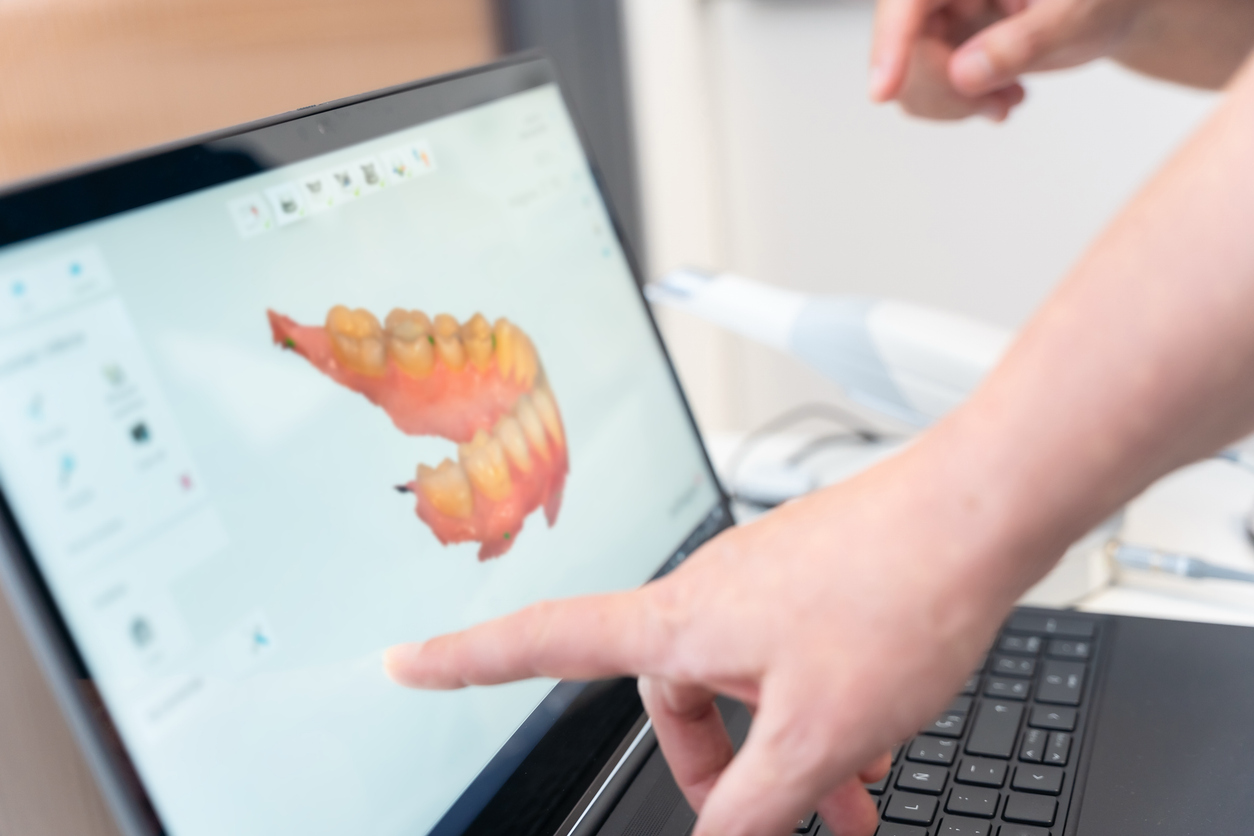 Dental professional reviewing a 3D digital scan to evaluate wisdom teeth.