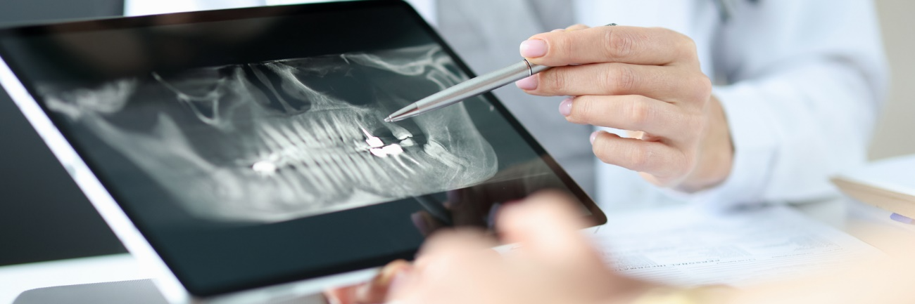 Dental professional pointing to an area of a jaw X-ray while reviewing the teeth and bone.